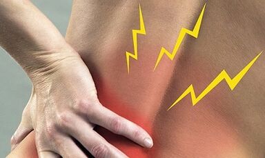 Lumbale osteochondrosikalische Symptome